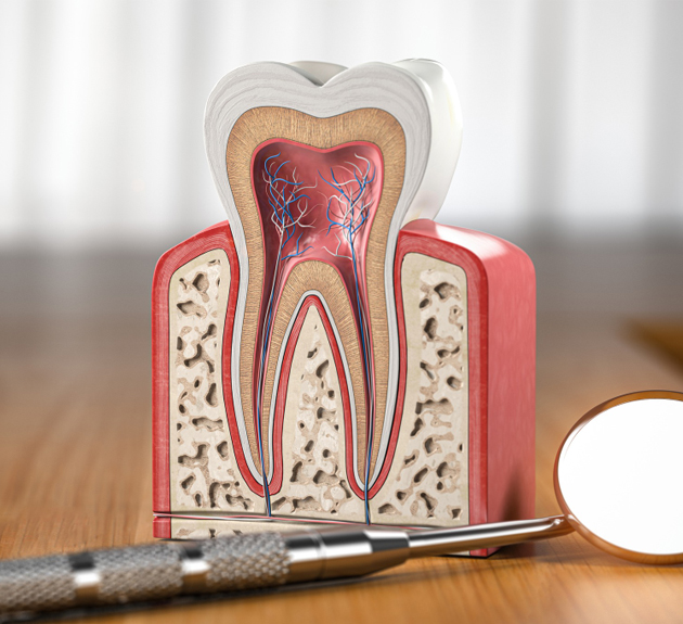 Root Canal Therapy Woodbridge