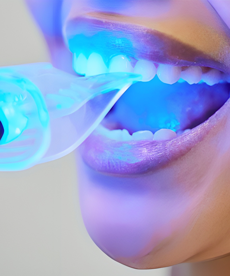 Teeth Whitening in Woodbridge