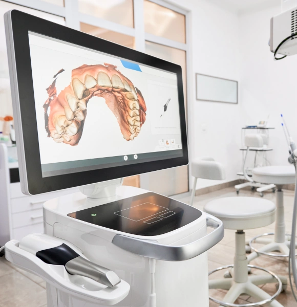 Dental scanner displaying 3D scan of teeth on monitor in modern dentistry office treatment room.