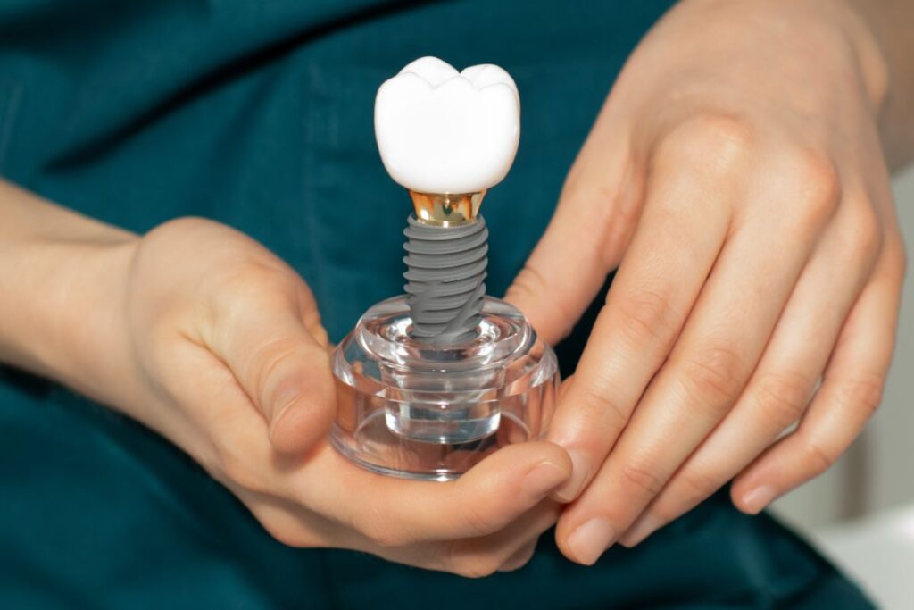 CARE YOUR GUM AFTER DENTAL IMPLANT